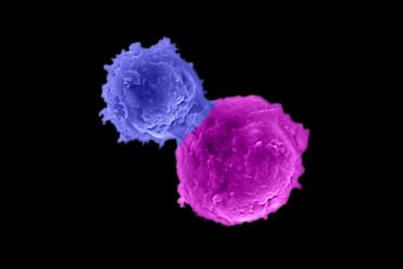 CAR-NKT cell in blue attacking a human multiple myeloma cell in magenta