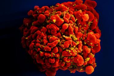 The improved therapy engineers the body’s immune response against HIV rather than waiting for the virus — or parts of the virus — to induce a response. (Image: A T cell infected with HIV.)