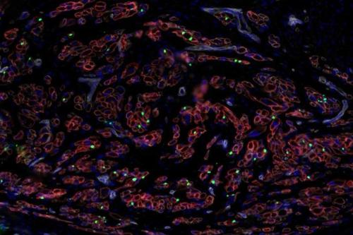 Lab-grown stem cells into muscle progenitor cells (green) and growing muscle fibers (red)