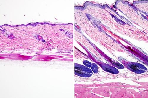 Untreated mouse skin showing no hair growth (left) compared to mouse skin treated with the drug UK5099 (right) showing hair growth. Credit: UCLA Broad Stem Cell Center/Nature Cell Biology