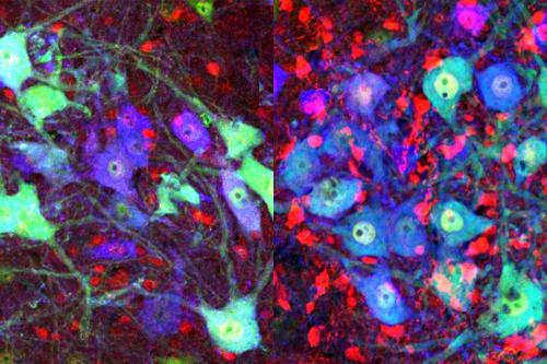 Image shows post-natal mouse spinal cord with the protein cofilin in red at left. At right, the cofilin (in red) has been inactivated by the gene Limk1. Neurons are shown in green and motor neurons in blue.