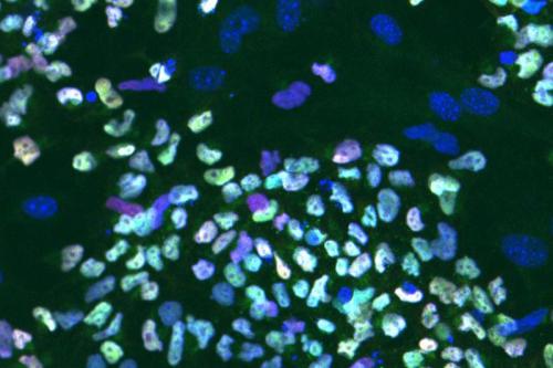 Microscope image of a colony of naive human embryonic stem cells showing the TFAP2C protein (green). The cells’ nuclei are blue