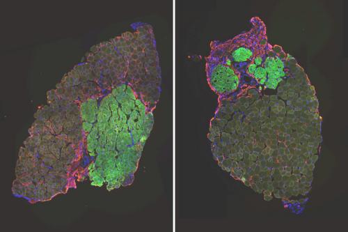 Microscopic images of regenerated mouse muscles transplanted with muscle stem cells (green) from old mice that have high levels of glutathione (left) and low levels of glutathione (right)