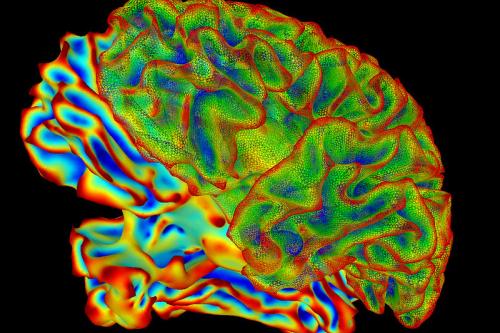 Image of a whole brain created using a computer image processing program called SUMA