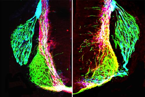 Left: axons (green, pink, blue) form organized patterns in the normal developing mouse spinal cord. Right: removing netrin1 results in highly disorganized axon growth.