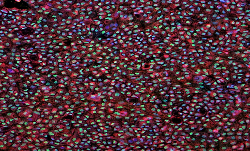 $5.1 million grant will fund research to develop a stem cell-based 