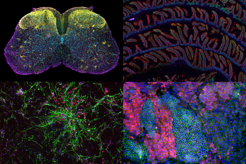 Announcing the winners of the Broad Stem Cell Research Center’s 2023 ...
