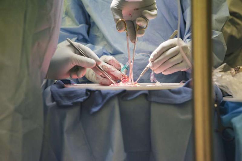 Gloved handed prepare a kidney for transplantation.
