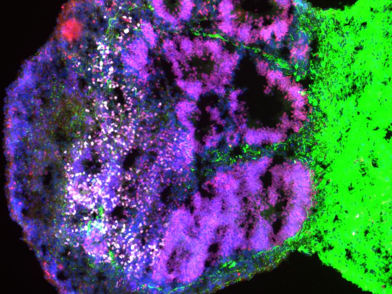 A cell image of a thalamocortical assembloid