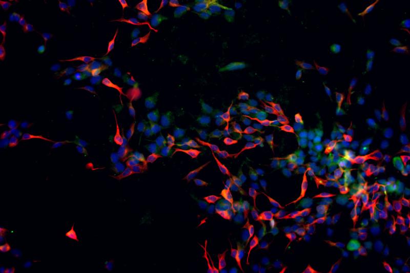 Microscopy image of neural progenitor cells derived from CRISPR-edited human induced pluripotent stem cells carrying an autism-associated genetic variant.