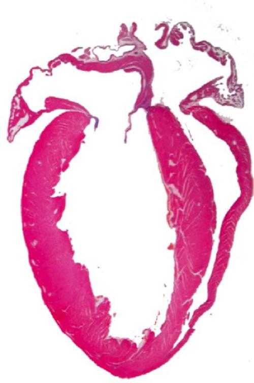 A microscopy image of a heart stained in bright magenta.