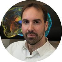 Headshot of Luis de la Torre-Ubieta, a man with short dark hair and a beard wearing a white shirt, with a colorful brain scan image visible in the background.