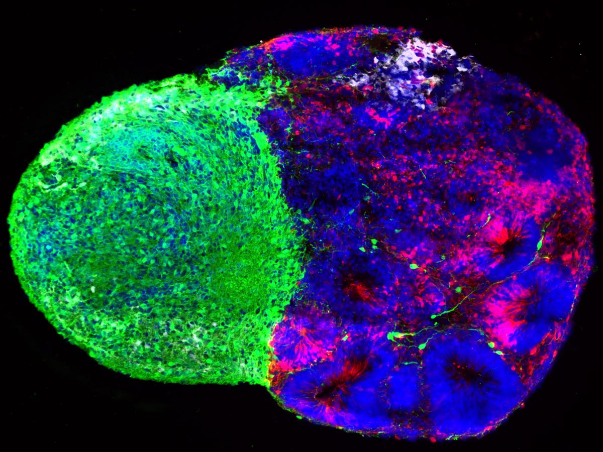 Fluorescence microscopy image of two fused stem cell-derived brain organoids, with the thalamic organoid shown primarily in green and the cortical organoid in red and blue. White radial glia are visible near the top where the two tissues meet.