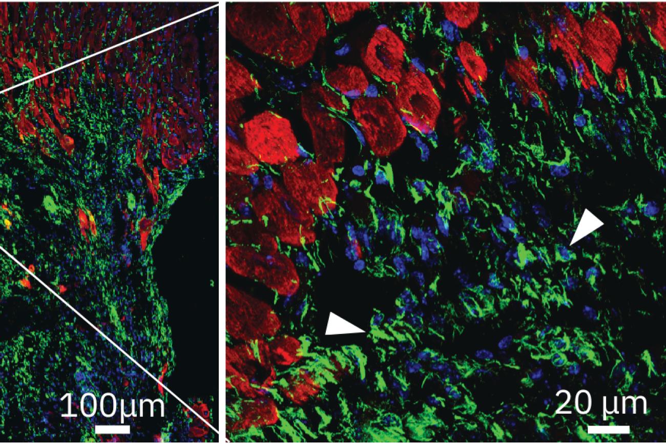 UCLA researchers engineer experimental drug for preventing heart failure after heart attacks