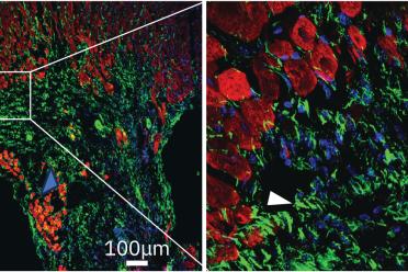 Microscopy image: Cardiac muscle shown in red and ENPP1 in green demonstrates expression of ENPP1 in the region of scar formation.