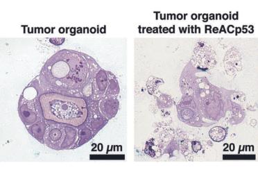 A side-by-side comparison of a tumor organoid before and after treatment. 