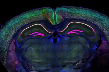 microscopy image of a mouse brain