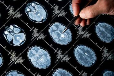 Brain scan images with a hand gesturing.
