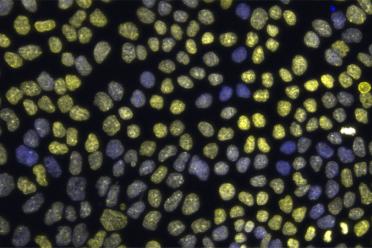 An image showing epithelial chromatin variation, with DNA (blue) and histone marker H3K27me3 (yellow) that represses gene activity