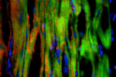 Researchers observed clusters of cardiac muscle cells (in red and green) derived from human embryonic stem cells 40 days after transplantation.