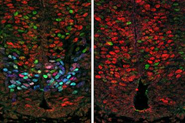 Left: Olig2 expression (blue) results in reduced Hes gene expression (red) and increased motor neuron formation (green) in the developing mouse spinal cord. Right: in the absence of Olig2, Hes expression increases and motor neuron formation decreases.