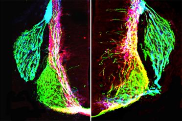 Left: axons (green, pink, blue) form organized patterns in the normal developing mouse spinal cord. Right: removing netrin1 results in highly disorganized axon growth.