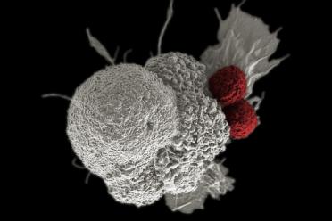 A cancer cell (white) being attacked by two T cells (red). 