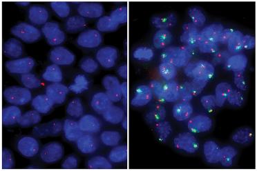 Left: Primed human embryonic stem cells have one active X chromosome (one red dot in each blue nucleus). Right: Naive human embryonic stem cells have two active X chromosomes (two red dots in each blue nucleus).
