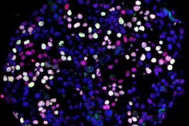 Differentiating human pluripotent stem cells (blue) turning into human germ cells (pink and white).
