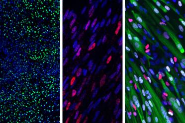 The new protocol turned 90 percent of human pluripotent stem cells into somite cells in just four days; those somite cells then generated (left to right) cartilage, bone and muscle cells.