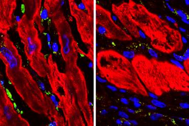 Microscopic images showing heart tissue in mice (with cardiac muscle cells in red) after a heart attack. Untreated tissue (left) shows more DNA damage (green) than tissue that has been treated with an experimental drug (right).