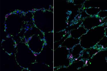 3-D bioengineered lung-like tissue (left) resembles adult human lung (right).