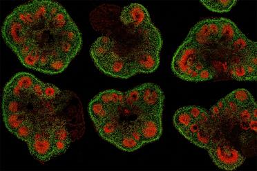 Slices of mini–brain organoids with neural stem cells (red) and cortical neurons (green)