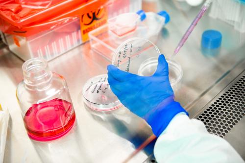 A gloved hand works with petri dishes in UCLA lab