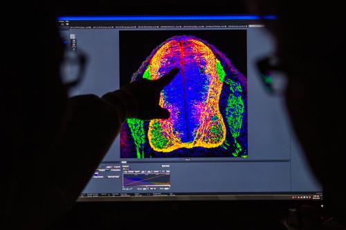 Two researchers observe a lab image on a computer, one pointing to the screen.