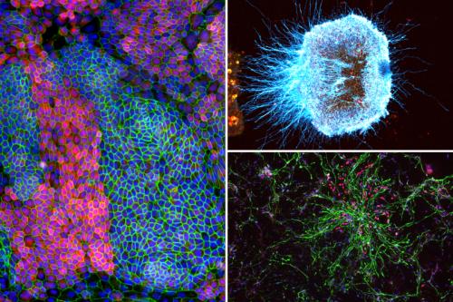 a collage of microscopy images