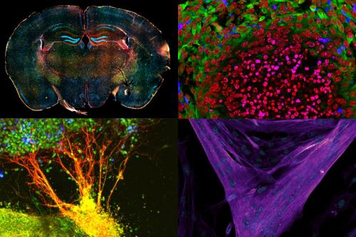 a collage of four microscopy images