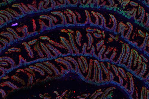 A microscopy image of intestinal cells.