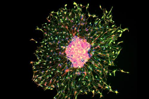 Image showing neural differentiation (with MAP2 protein in green and GFAP protein in red) in a neurosphere derived from mouse neural stem and progenitor cells.