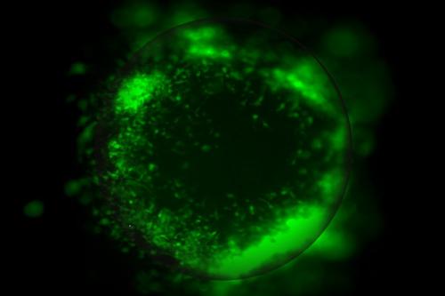 Green fluorescent tumor cells in brain organoid under microscope