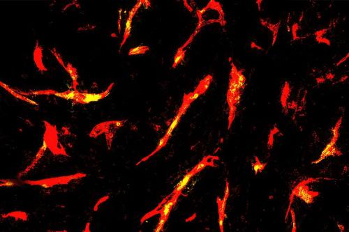 Microscopy image of blood vessels (red) in a mouse glioma tumor after CAR-T cell treatment. Yellow shows areas with good blood flow, highlighted using tomato lectin, a protein that marks vessels. 