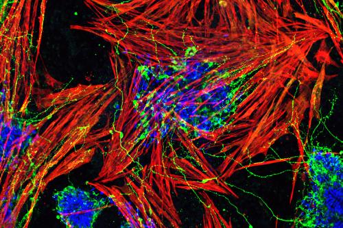 This image depicts the simultaneous differentiation of muscles and motor neurons from the mouse embryonic stem cell-derived NMPs. The cultures were fixed and stained with neurons and muscle-specific antibodies. Motor neurons are labeled with a neuronal marker-Tuj1 (in green).