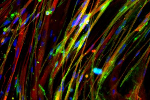 A microscopy image demonstrating restoration of beta dystroglycan in muscle myotubes derived from CRISPR/Cas9 corrected DMD human induced pluripotent stem cells. 