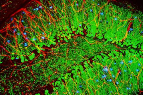 Mouse brain showing hallmarks of Alzheimer’s disease (plaques in blue)