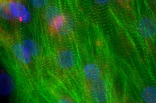 Fluorescent green striated muscle fibers with large blue and pink nuclei.