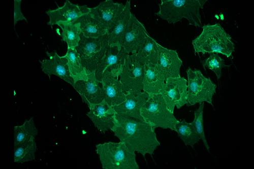 Blood-brain barrier cells stained in a fluorescent green