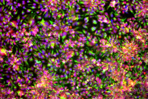 Dense fluorescent cell culture with pink nuclei and green connections.
