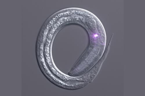 A human-parasitic larva with its neurons shown in white