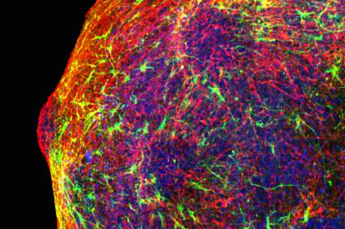 Fluorescence microscopy of a cortical spheroid showing a dense, rounded tissue structure composed of an intricate, tangled web of red and green fibrous networks over a deep blue background.