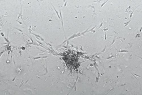 A microscopy image of cutaneous neurofibroma organoids